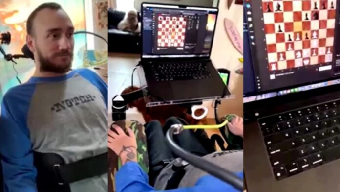 Implante cerebral permite jogar xadrez em laptop, revela paciente da Neuralink